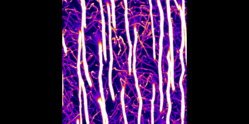 dentin porosity