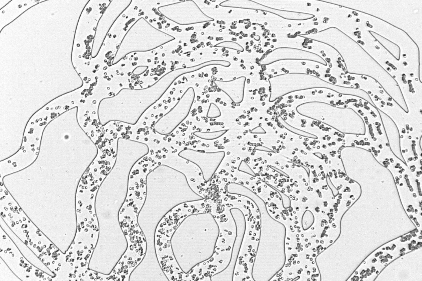 Diabetes, retina and blindness: the silent danger of vascular occlusions